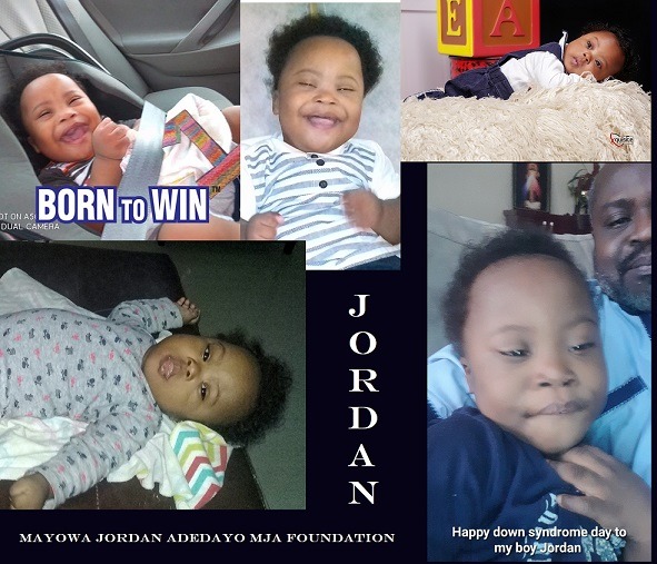 This Blog Post is dedicated to my 5-year old son who has down syndrome, and is a Sickle cell warrior. This Blog post marks the beginning of my search for collaborators to help find cure to DS and SS and also the possibility of Crowdfunding for him and other sufferers to get Bone Marrow Transplant (BMT) cure for SS and any possibility for a very much improved lifestyle of Down Syndrome patients with Elon Musk's Neuralink.

Mayowa Jordan Adedayo MJA Foundation(c)2024 planetbridgelimited.com